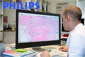 Philips digital pathology gets a first FDA nod for primary diagnostic use