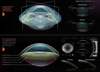 Trained by a Robot: How my Femtosecond Laser Makes Me a Better Cataract Surgeon