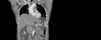 Setting New Standards in CT Imaging - GE Healthcare