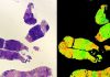 ‘Digistain’ technology offers uprising in detailed cancer diagnosis