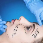 plastic_surgery