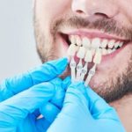 Cosmetic Dentistry Treatment Options And Side Effects1
