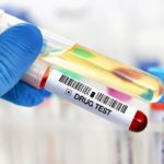 5 Common Methods For Testing Drug And Alcohol Consumption1