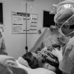 Breast Augmentation1