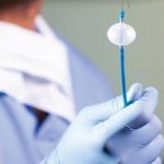 CRYOABLATION