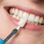 Enhancing Your Smile