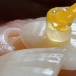 Enhancing Your Smile1