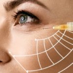 Platelet Rich Plasma (PRP) Injections1