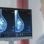 Radiotherapy