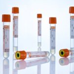 VACUETTE_serum_Fast_withGel