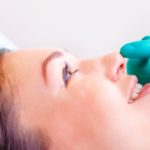 rhinoplasty