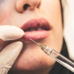 Botox Bliss