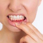 Dental Care