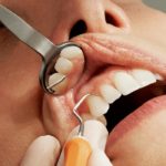 Dental Hygiene1