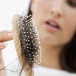 Hair Loss