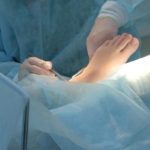 Surgery