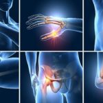 Chronic Pain1