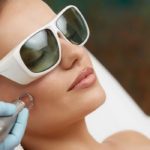 Skin Imperfections1