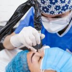 Scalp Micropigmentation