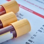 Blood Tests