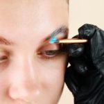 Eyelid