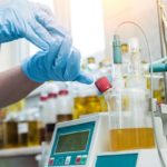 Urine Output Monitoring