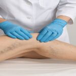 Minimally-Invasive-Venous-Treatments