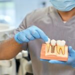 The-Benefits-of-Opting-for-Dental-Implants-Over-Other-Treatments
