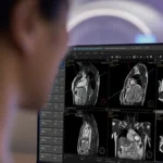 Cardiac-MR-Suite-by-Philips