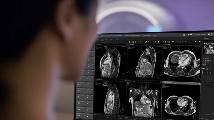 Cardiac MR Suite by Philips