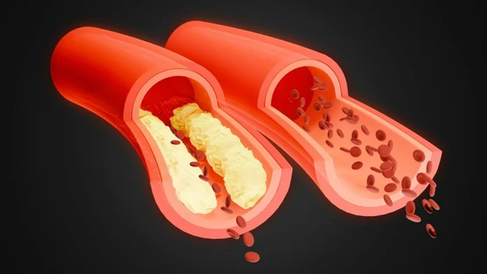 Peripheral-Arterial-Disease-warning-signs-and-treatments Peripheral Arterial Disease warning signs and treatments