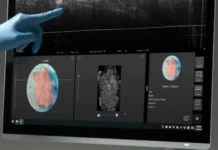 Intermountain Health Brings Perimeter’s Claire™ to the Operating Room, a Landmark in Breast Cancer Surgery Using AI Breast Cancer Surgery Using AI