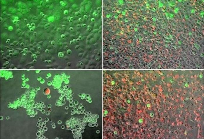 news - 11129-pancreatic-cancer-cells.jpg