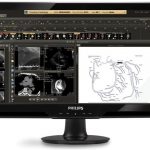 Cardioinformatics