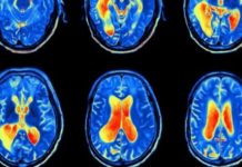 Preclinical imaging technology now driving cancer research