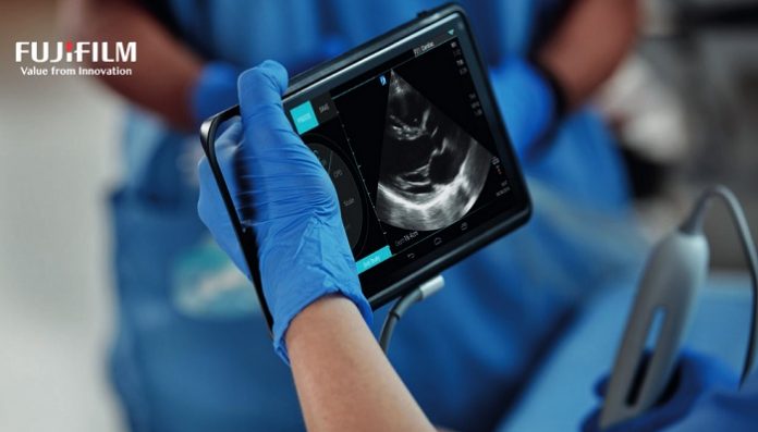 FUJIFILM SonoSite Ultrasound imaging