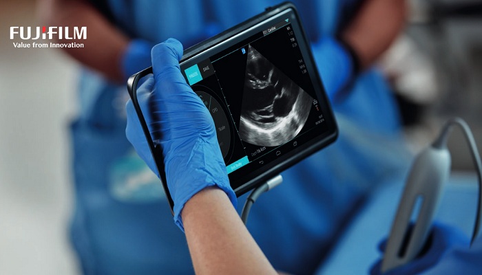 FUJIFILM SonoSite and Partners HealthCare Endeavor to Make Point-of-Care Ultrasound Accessible for Higher Quality Patient Care