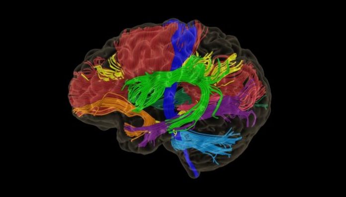 Synaptive Medical Modus PlanTM