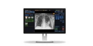 Carestream to Launch Budget-Friendly Focus 35C Detector and Retrofit Solution with Image Suite Software