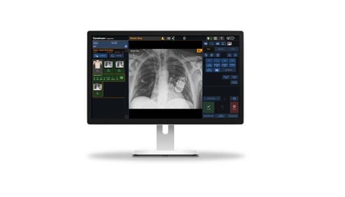 Carestream to Launch Budget-Friendly Focus 35C Detector and Retrofit Solution with Image Suite Software