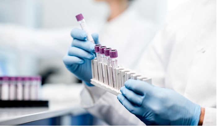 GRAIL Announces Validation of its Multi-Cancer Early Detection Test Published in Annals of Oncology