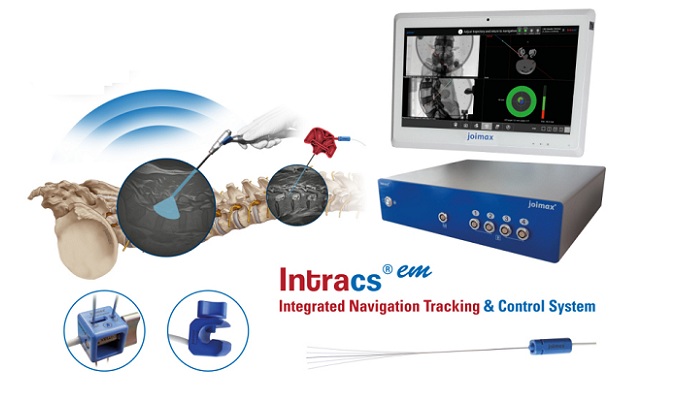 FDA Approves joimax Intracs Electromagnetic Navigation System for Endoscopic Minimally Invasive Spine Surgery