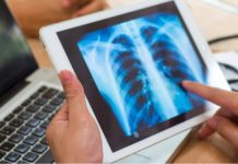 eNose technology helps to diagnose interstitial lung disease