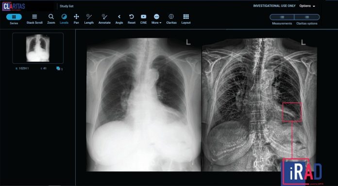 Singapore's Claritas HealthTech launches Claritas iRAD