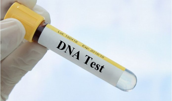 4 Things to Know Before You Take a Home DNA Test