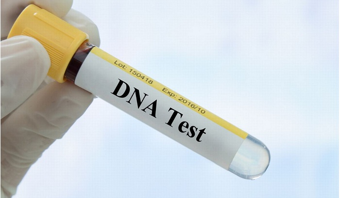 4 Things to Know Before You Take a Home DNA Test