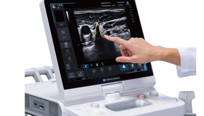 Konica Minolta Debuts Next-generation Ultrasound System, the SONIMAGE HS2
