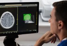 Philips Incisive CT gets even smarter with debut of AI-enabled Precise Suite