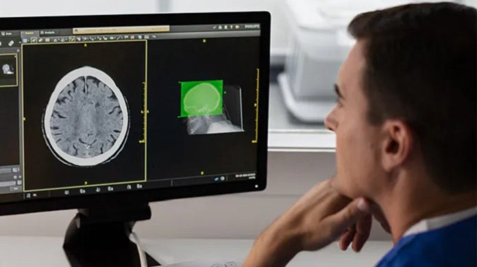 Philips Incisive CT gets even smarter with debut of AI-enabled Precise Suite