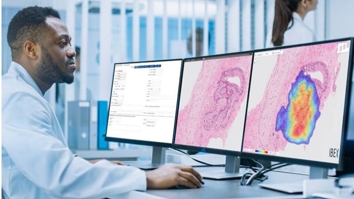 Ibex Medical Analytics raises $38M for its AI-powered cancer diagnostic platform